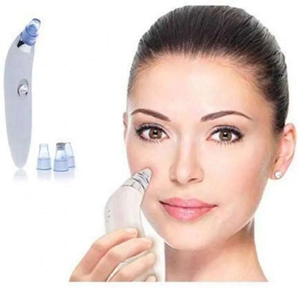 4 in 1 Derma Vacuum Suction Blackhead/Acne/Oil/Pore Cleaner 🌞💁♀️